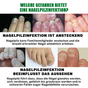 Ingwer-Nagelpflegelösung