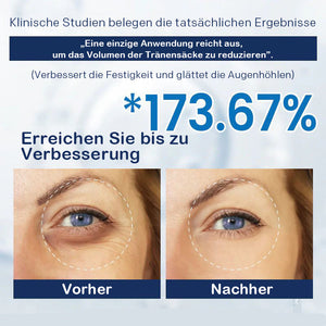 Creme gegen Tränensäcke – 💖Kaufen Sie eins und bekommen Sie eins gratis (2 Stück)💖