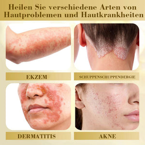 Konzentrierte Bienengift-Hautreparaturcreme