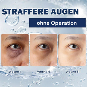 Creme gegen Tränensäcke – 💖Kaufen Sie eins und bekommen Sie eins gratis (2 Stück)💖