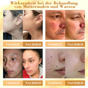 Konzentrierte Bienengift-Hautreparaturcreme