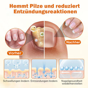 Bienengift-Nagelreparaturspray