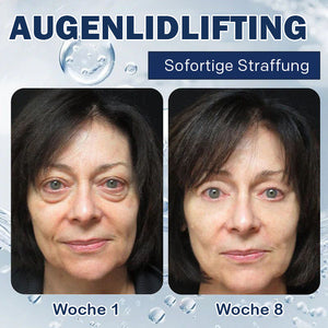 Creme gegen Tränensäcke – 💖Kaufen Sie eins und bekommen Sie eins gratis (2 Stück)💖