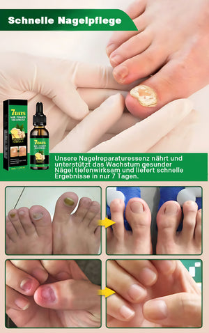 Ingwer-Nagelpflegelösung