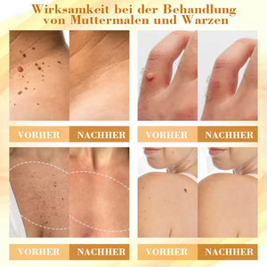 Konzentrierte Bienengift-Hautreparaturcreme