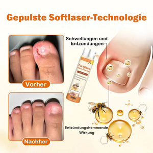 Bienengift-Nagelreparaturspray