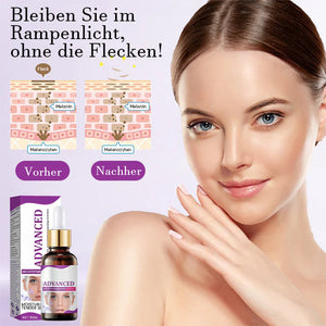Fortschrittliches Anti-Pigmentierungsserum