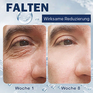 Creme gegen Tränensäcke – 💖Kaufen Sie eins und bekommen Sie eins gratis (2 Stück)💖