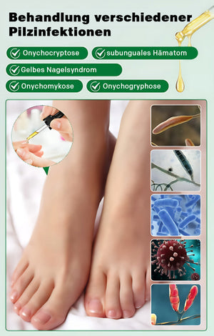 Ingwer-Nagelpflegelösung