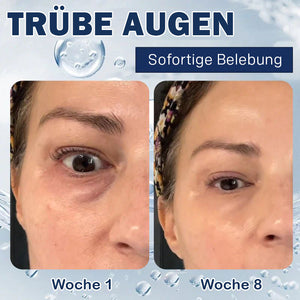 Creme gegen Tränensäcke – 💖Kaufen Sie eins und bekommen Sie eins gratis (2 Stück)💖