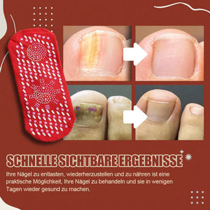 Anti-Pilz-Socken für Nägel