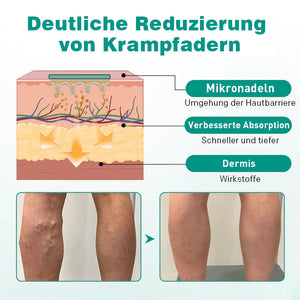 Topisches Pflaster für erhöhte Venen