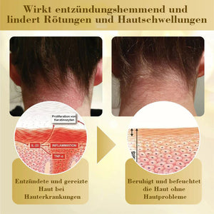 Konzentrierte Bienengift-Hautreparaturcreme