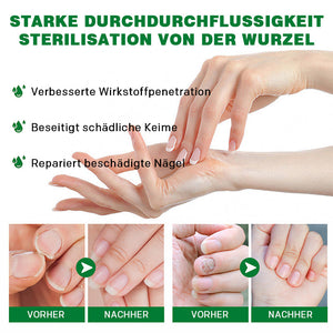 Ingwer-Nagelpflegelösung