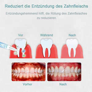 Reparaturgel für die Zähne (Kaufe 1 erhalte 1 kostenlos)