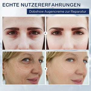 Creme gegen Tränensäcke – 💖Kaufen Sie eins und bekommen Sie eins gratis (2 Stück)💖
