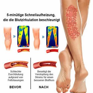 Radiofrequenz-Kräuter-Thermal-Kniebandage