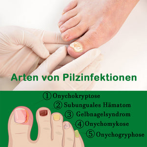 Ingwer-Nagelpflegelösung