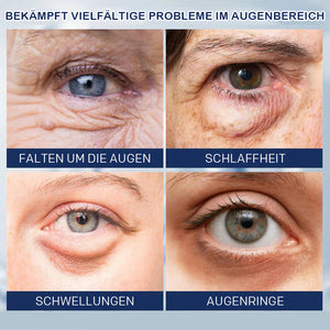 Creme gegen Tränensäcke – 💖Kaufen Sie eins und bekommen Sie eins gratis (2 Stück)💖
