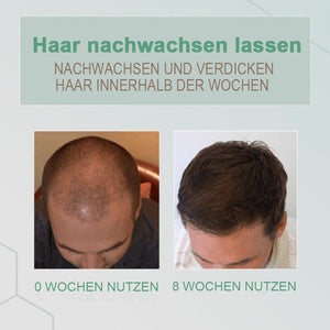 GingerGrowth Anti-Haarausfall-Spray